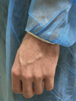 Халат хирургический с резинкой на завязках (10 шт/уп) BETAtex, синий